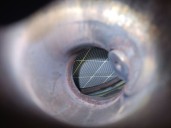 Recambio de catalizador para citroën c4 lim. collection referencia OEM IAM PSAK686 9808329780 PSAF026