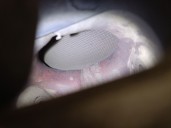 Recambio de filtro de particulas para hyundai bayon (bc3) 1.2 mpi referencia OEM IAM W08310 2853008310 